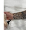 Eliminación de Tatuaje Grande | Laser Esthetic