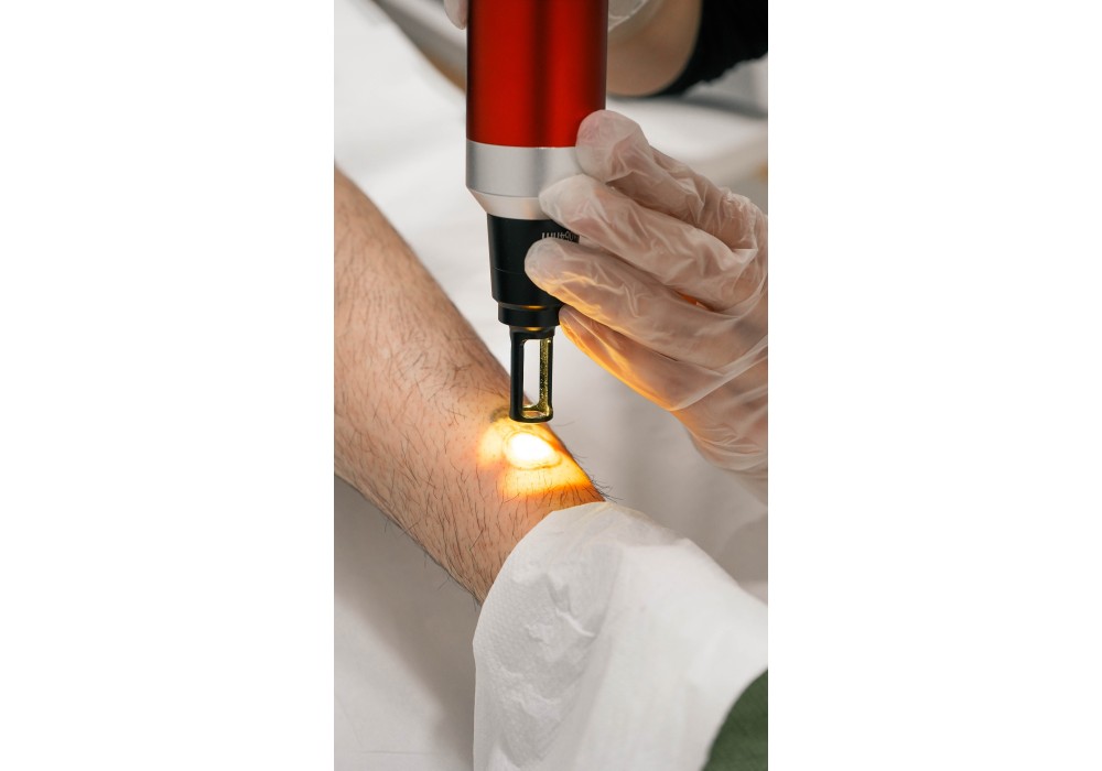 Eliminación Tatuaje XS  | Laser Esthetic