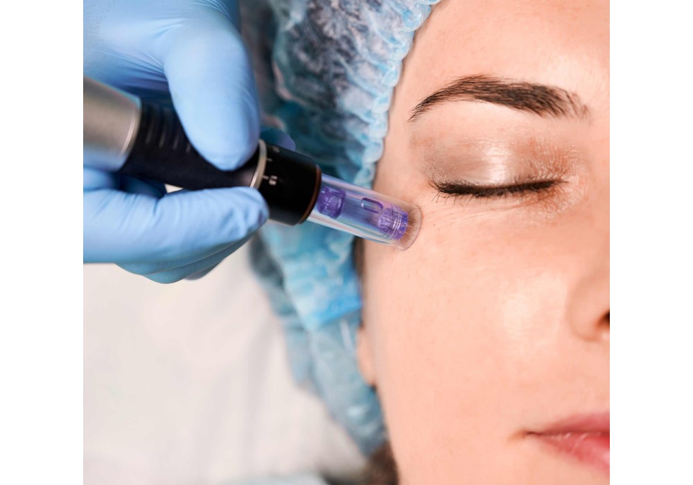 Dermapen + Fototerapia Bono 3 Sesiones | Laser Esthetic