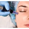 Dermapen + Fototerapia Bono 3 Sesiones | Laser Esthetic