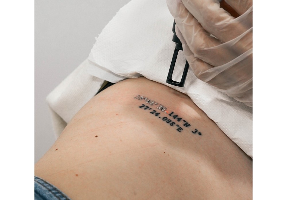 Eliminación Tatuaje Mediano | Laser Esthetic