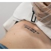 Eliminación Tatuaje Mediano | Laser Esthetic