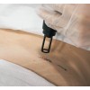 Eliminación Tatuaje Pequeño | Laser Esthetic