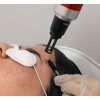Eliminación de Micropigmentación | Laser Esthetic
